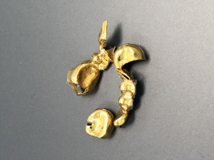金歯