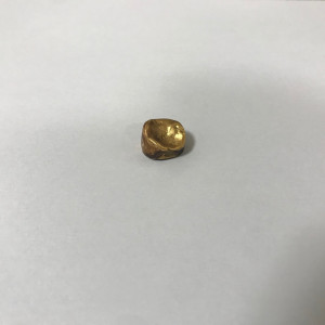 金歯