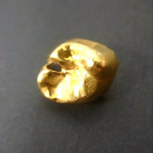 金歯
