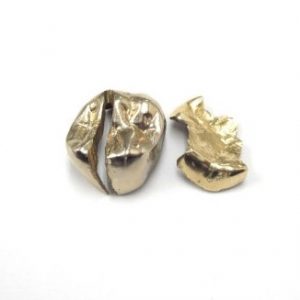金歯