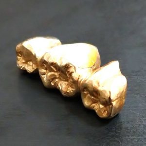 金歯