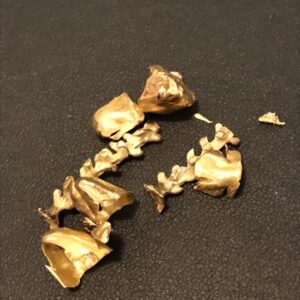 金歯