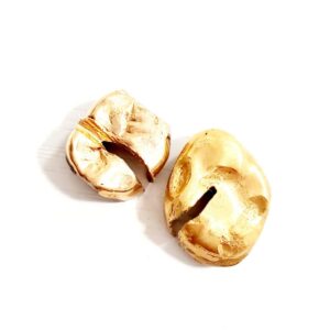 金歯