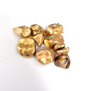 金歯 まとめ