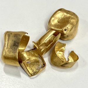 金歯