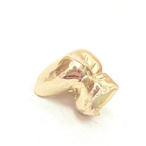 金歯