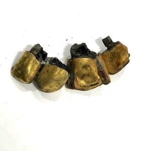 金歯