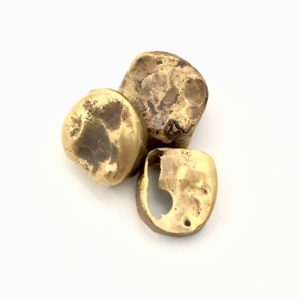 金歯 まとめ