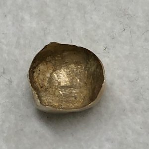 金歯