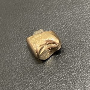 金歯
