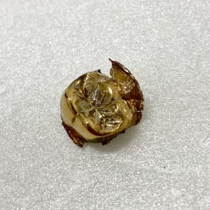 金歯