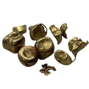 金歯（クラウン）