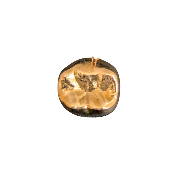 金歯