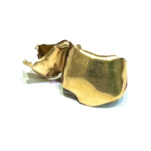 金歯 歯科金属 おまとめ