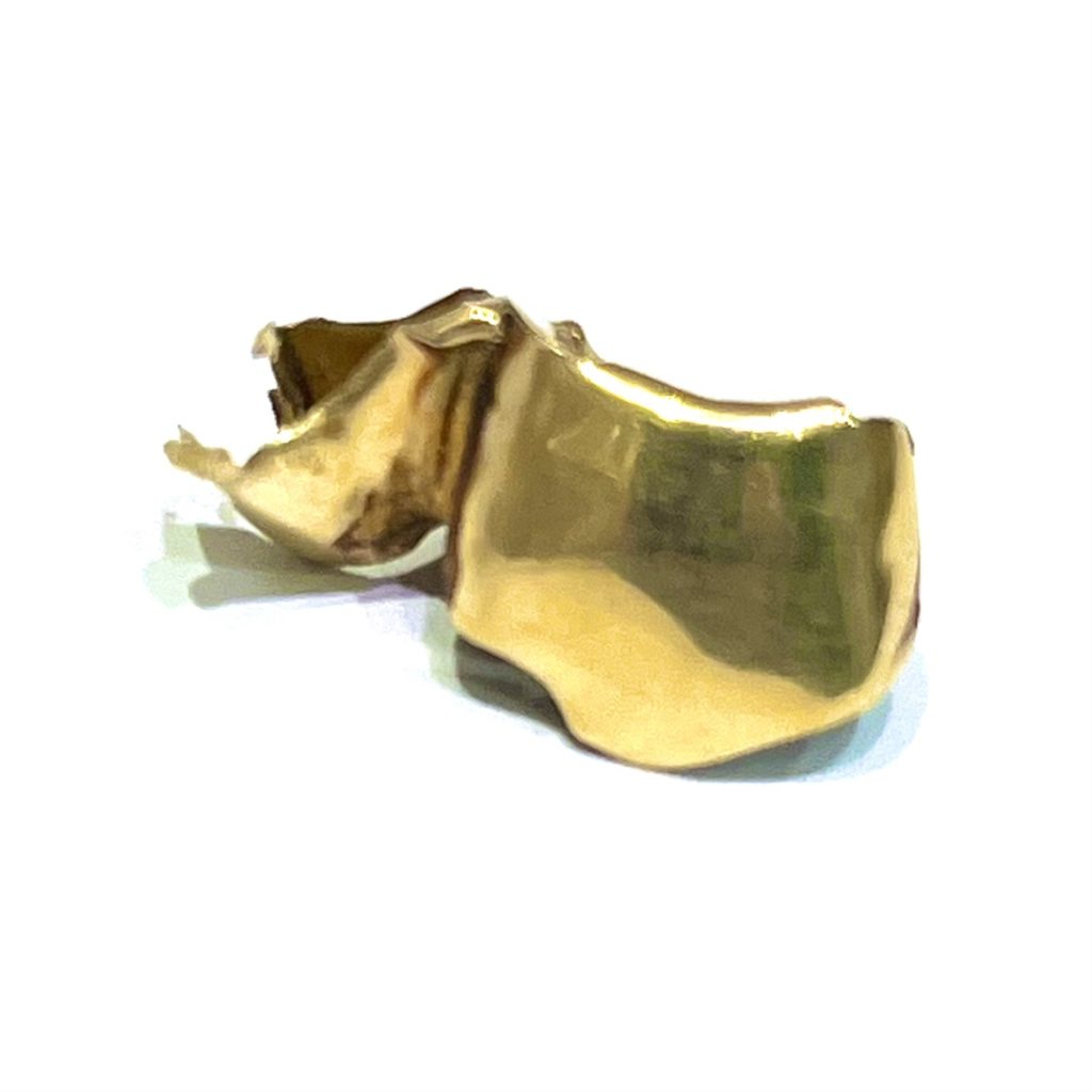 金歯 歯科金属 おまとめ