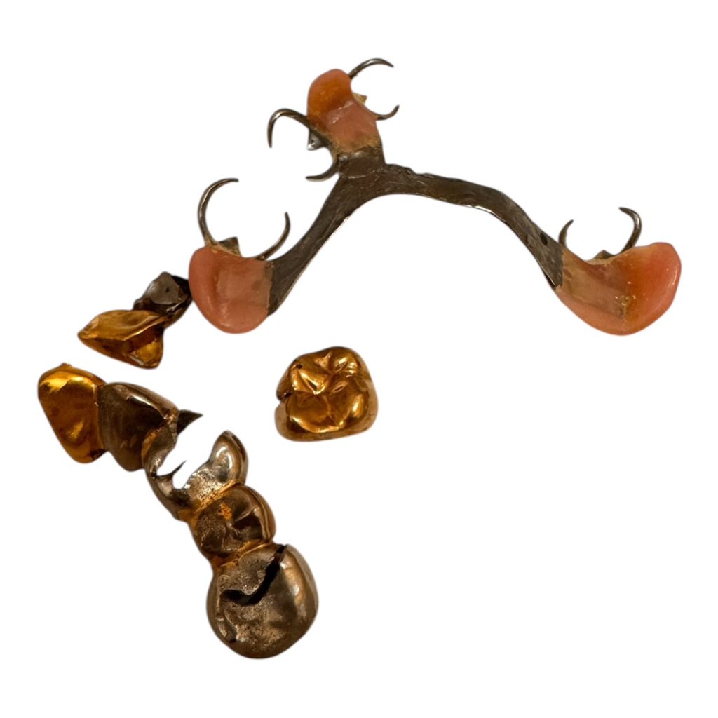 金歯・銀歯　おまとめ