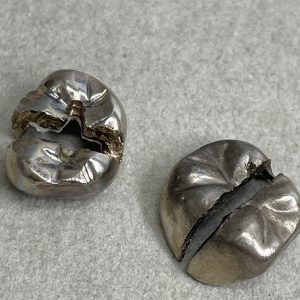 銀歯、金歯、入れ歯も買取強化中！| 銀歯の買取 | 取手市井野団地