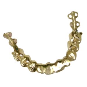 金歯 札幌市 東区 元町