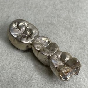 金歯・銀歯のでお買取ならさすがや！| 銀歯の買い取り| 我孫子市南青山