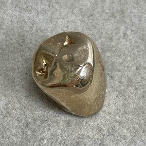 入れ歯、金歯のお買い取り|金歯のお買い取り| 取手市藤代