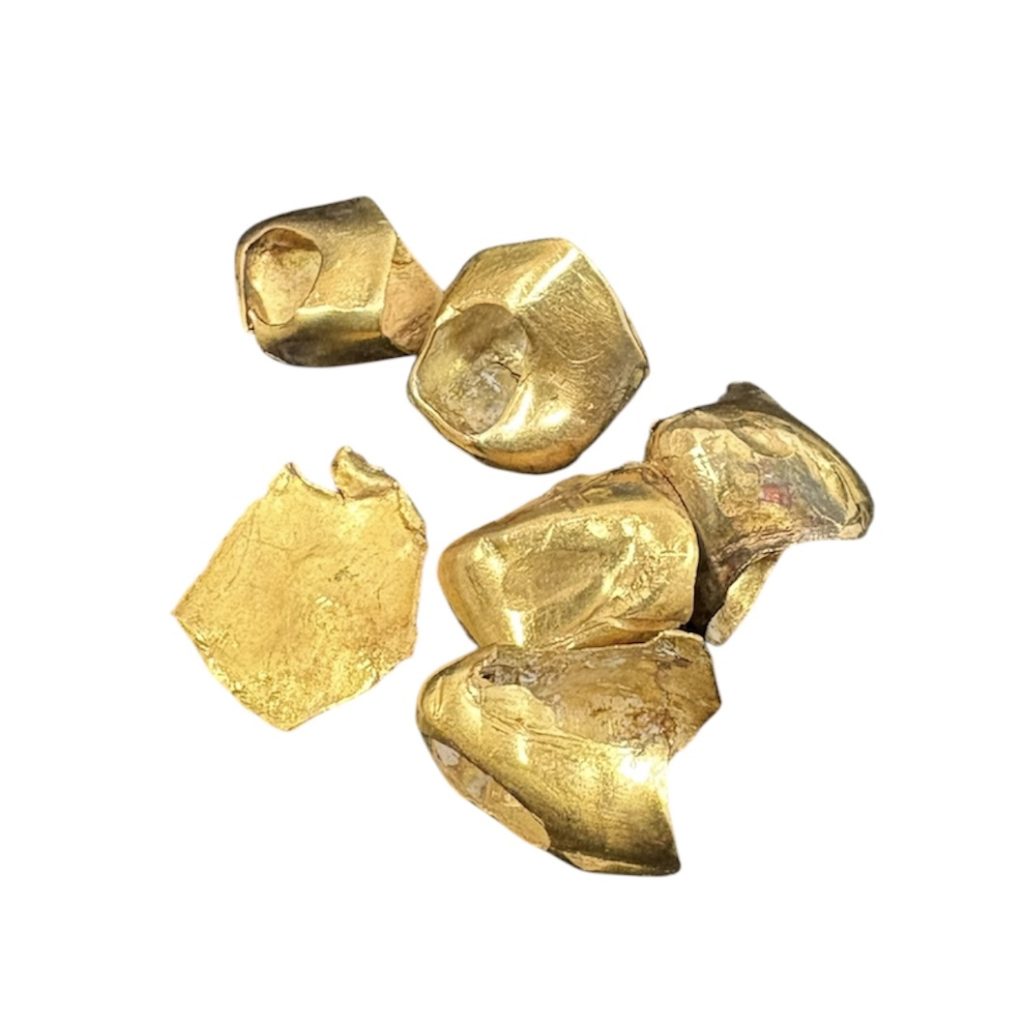 金・ 金歯 まとめ