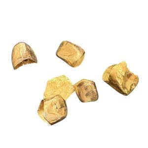 金 金歯　まとめ