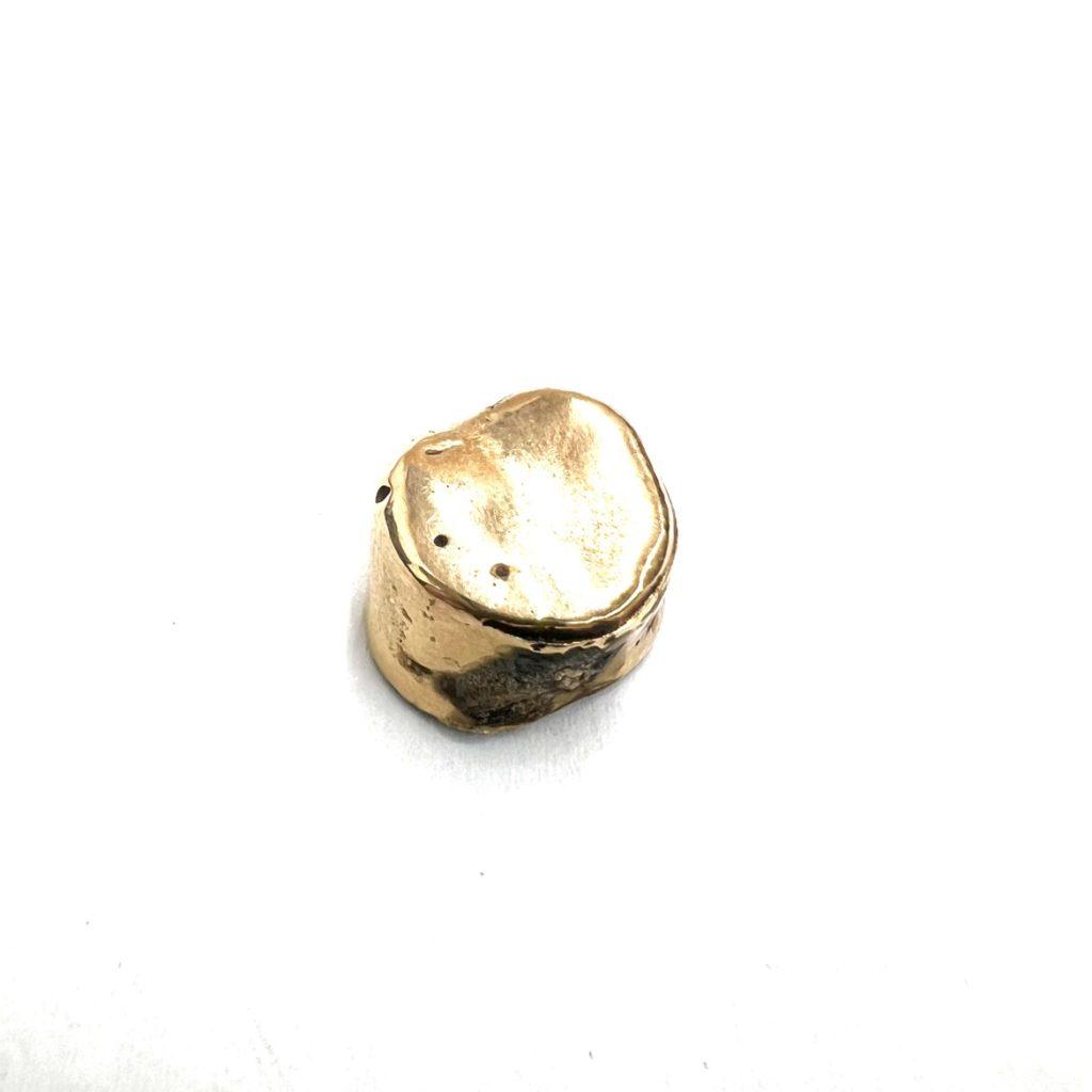 金歯