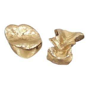 金歯