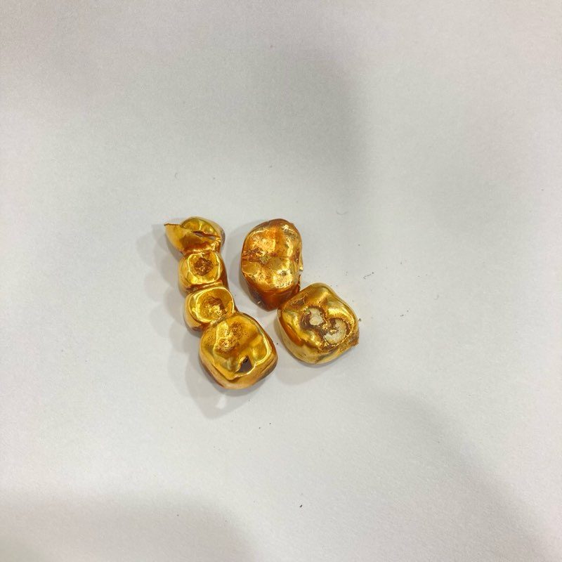 金歯