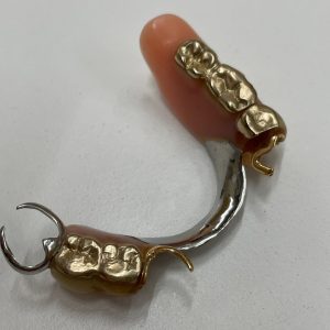 金歯・入れ歯の買取ならさすがや福生銀座いなげや店！| 西多摩郡瑞穂町長岡長谷部| 入れ歯