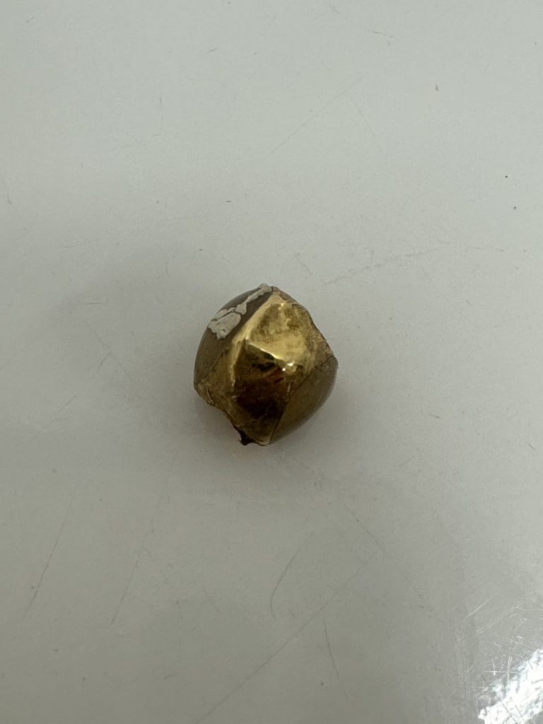 金歯