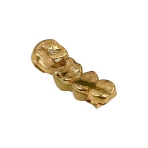 金歯 / 銀歯 / 歯付き / 貴金属